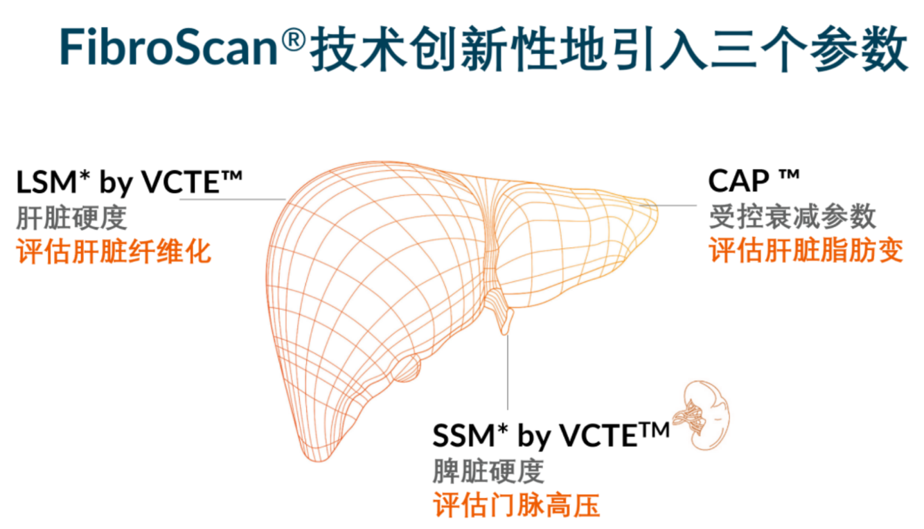 喜訊！FDA擴(kuò)大了FibroScan?在肝臟綜合管理中的應(yīng)用范圍